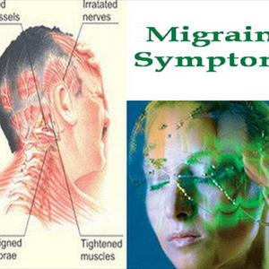 Ophthalmoplegic Migraine Eye - New Migraine Treatment You Must Know
